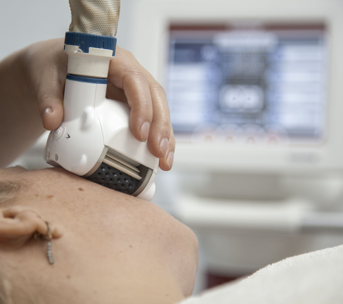 Icoone Laser behandeling